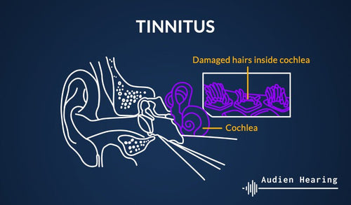 Diagram showing the inner ear and tinnitus
